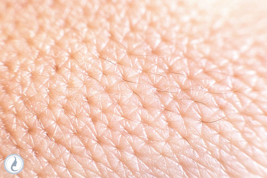 microneedling for pores