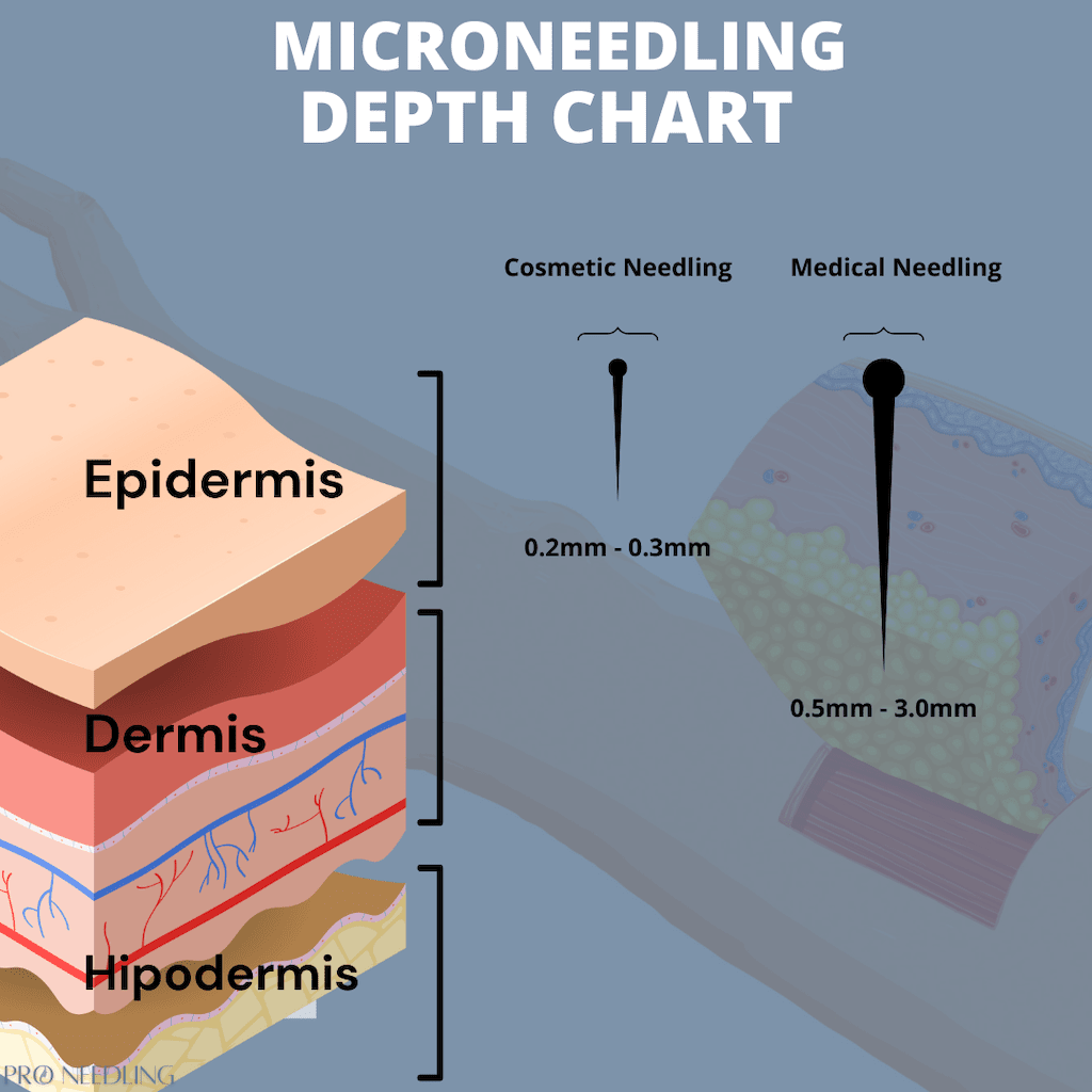 Microneedling Depth Guide Pro Needling