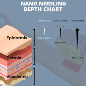 NanoNeedling: Better Than Microneedling? - Pro Needling